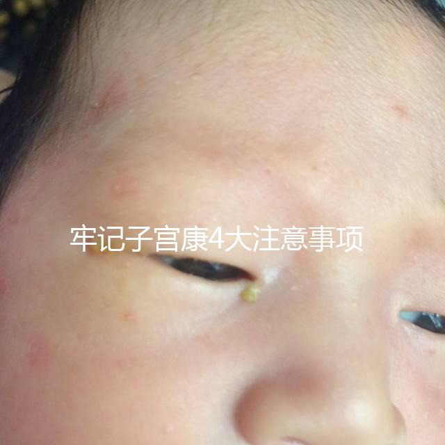 牢記子宮康4大注意事項，輕松避免胃脹、腹瀉等副作用