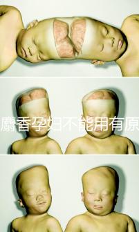 白麝香孕婦不能用有原因，流產(chǎn)、早產(chǎn)…這些危害不得不知