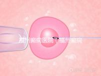 福州癲癇醫院(福州癲癇醫院在哪里)