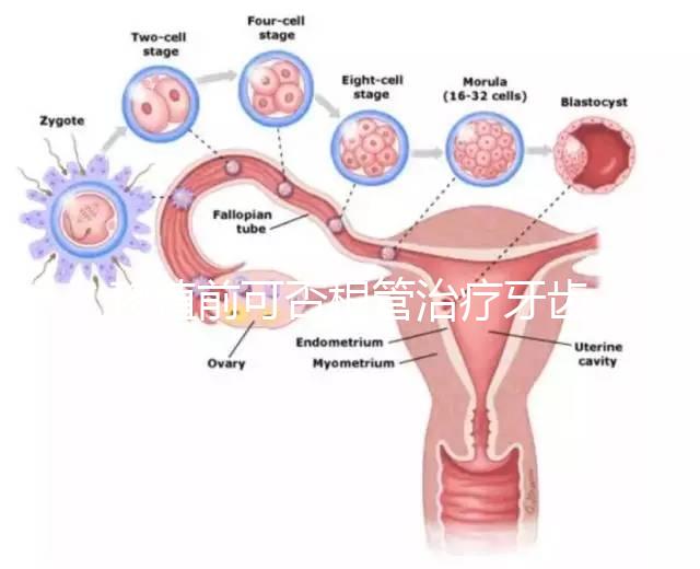 移植前可否根管治療牙齒看情況，這些影響別還不知道
