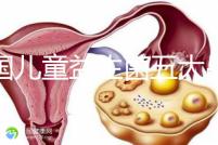 美國(guó)兒童益生菌五大品牌排行榜，康萃樂(lè)、家得路榜上有名