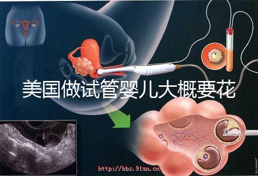 美國(guó)做試管嬰兒大概要花多少錢？具體支出25w！