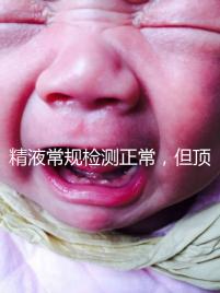 精液常規(guī)檢測(cè)正常，但頂體酶低，是否影響試管嬰兒成功率？