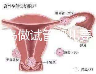 去青島做試管嬰兒要多少錢？