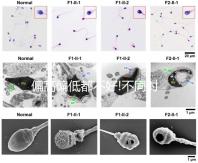 偏高偏低都不好!不同時(shí)期促卵泡成熟激素正常值一覽