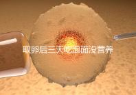 取卵后三天吃泡面沒營養?3個小妙招“變廢為寶”