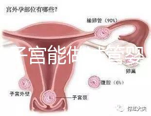 雙角子宮能做試管嬰兒嗎？可以，但這2大條件缺一不可