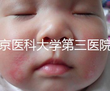 北京醫(yī)科大學(xué)第三醫(yī)院nt檢查費(fèi)用盤點(diǎn)需要多長(zhǎng)時(shí)間，是否預(yù)約