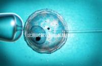 北京試管雙胞胎醫(yī)院排名出爐！西城區(qū)這些機(jī)構(gòu)成功率高