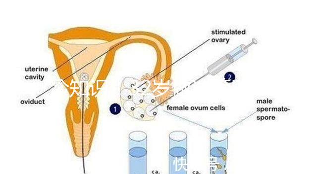 冷知識！32歲做試管嬰兒提升成功率的方法請收藏