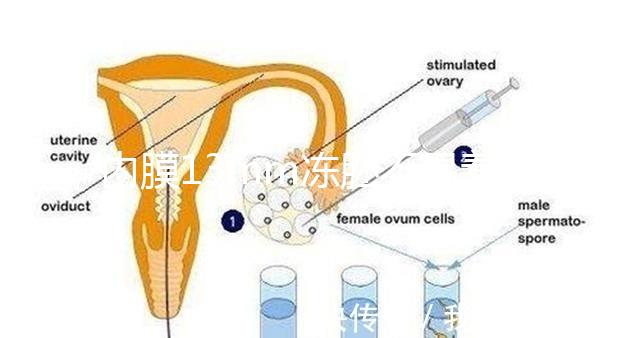 內膜13mm凍胚不易著床要注意，移植與否看醫生怎么說