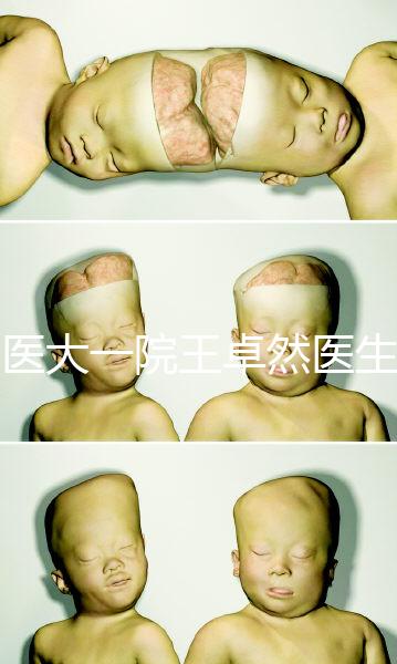 哈醫大一院王卓然醫生試管攻略,坐診時間、成功率早知道