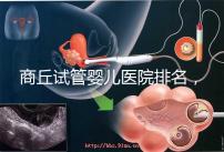 商丘試管嬰兒醫院排名，附3家公立機構助孕成功率和費用