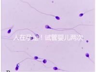 人在孕途!試管嬰兒兩次胎停育,了解這幾招能降低流產(chǎn)風(fēng)險(xiǎn)