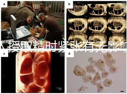 人授取精時(shí)緊張有無(wú)影響別還不造,注意事項(xiàng)不少不可不知