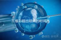 二維彩超出結(jié)果的時(shí)間并不長(zhǎng),從檢查流程便可看出