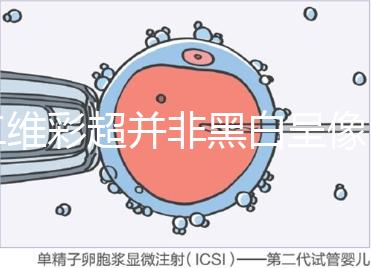 二維彩超并非黑白呈像，通過檢查還能看清胎兒五官