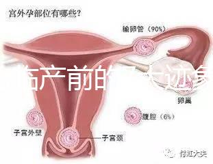 二胎臨產前的7大跡象，出現見紅、陣痛別大意