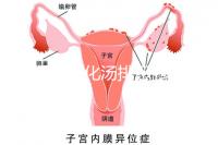 產(chǎn)后喝生化湯排惡露會使寶寶拉肚子?醫(yī)生:時(shí)間沒用對