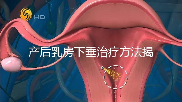 產后乳房下垂治療方法揭秘，按摩手法再好也沒提前預防有用