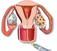為什么不建議12月齡寶寶打水痘疫苗，醫生道出其中端倪