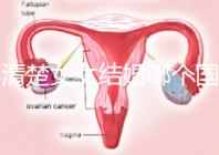 不清楚女女結(jié)婚哪個(gè)國家能領(lǐng)證來看,歐洲這些地區(qū)都可