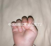 中信湘雅試管嬰兒花了20萬?單周期價(jià)格真沒這么貴