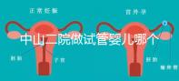 中山二院做試管嬰兒哪個(gè)醫(yī)生好?附醫(yī)院試管成功率