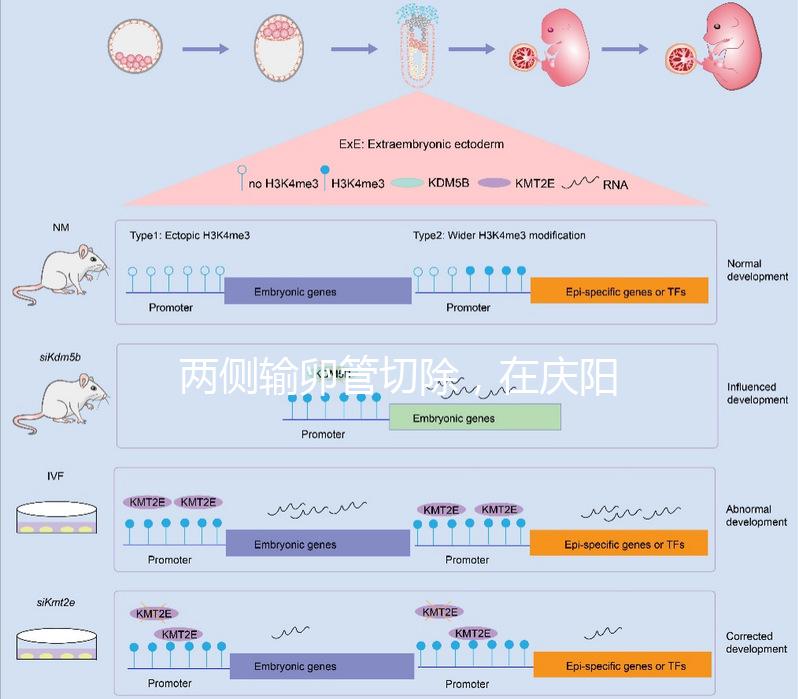 兩側輸卵管切除，在慶陽有醫院能做試管嬰兒嗎？