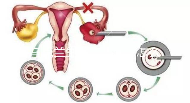 烏克蘭生的小孩回來怎么上戶口一文說清，含落戶政策