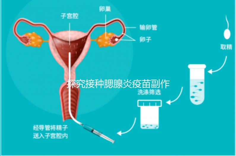 探究接種腮腺炎疫苗副作用,出現發(fā)燒用這3招應對自如