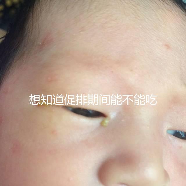 想知道促排期間能不能吃草莓看過來,怎么吃不發胖有講究