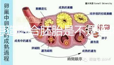 想造融合胚胎是不是連體嬰兒看這，容不容易雙胎一文講清
