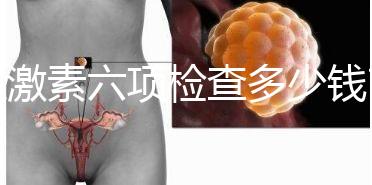 性激素六項(xiàng)檢查多少錢(qián)?最終花費(fèi)受這3個(gè)方面影響