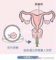 打了艾澤250ug幾天能代謝完戳，第十天別還不敢走下一步