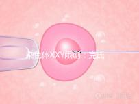 染色體XXY鬧?。嚎耸暇C合征，帶你走進“第三性別”群體