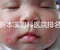 更新本溪男科醫(yī)院排名,不要錯(cuò)過(guò)本溪湖區(qū)top3醫(yī)生的專業(yè)