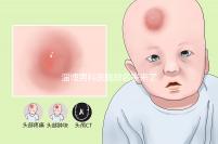 淄博男科醫院排名表來了2024年哪個口碑好？網友怎么說？