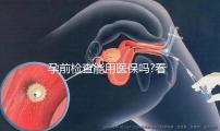 孕前檢查能用醫(yī)保嗎?看看過(guò)來(lái)人都是怎么說(shuō)的