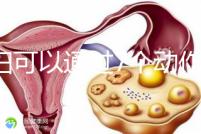 孕婦可以通過7個(gè)動作緩解坐骨神經(jīng)痛,并按摩一篇文章來解釋