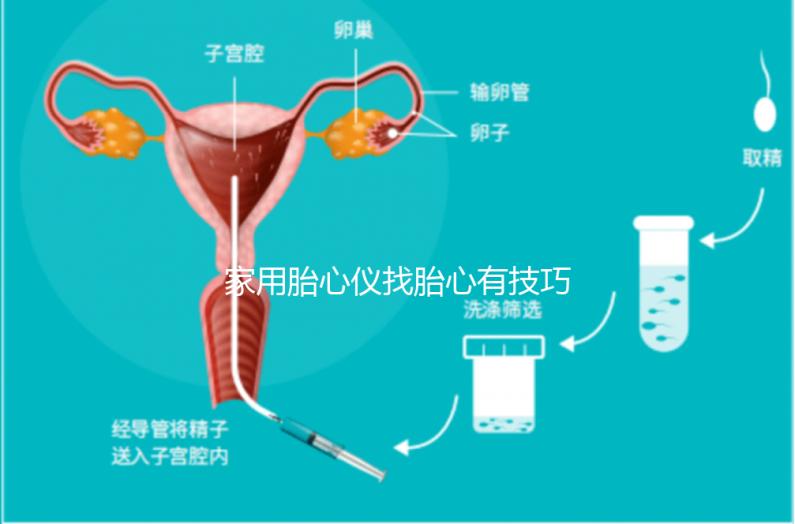 家用胎心儀找胎心有技巧，飯后半個小時測準確率稍高