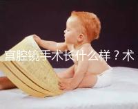 宮腔鏡手術(shù)長(zhǎng)什么樣?術(shù)后要注意什么? ?