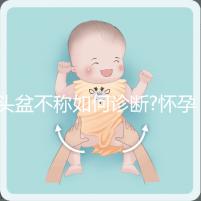 頭盆不稱如何診斷?懷孕9月查出頭盆不稱，是順還是剖