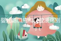 嬰兒鵝口瘡和口腔潰瘍別分不清，兩者癥狀圖片輕松分辨