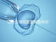 山大生殖試管案例告訴你，歷經3個月后懷孕辛酸史