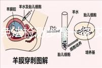 酶免法檢測(cè)步驟一覽 艾滋病