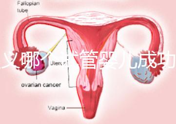 遵義哪個試管嬰兒成功率高？貴州生殖中心醫(yī)院2024年排名參考