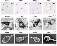 那個(gè)國(guó)家做試管嬰兒不要結(jié)婚證