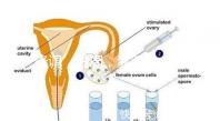 降調，進周，囊胚……這些試管嬰兒助孕術語你都懂嗎？