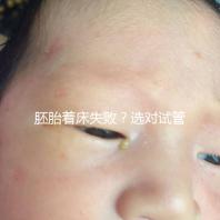 胚胎著床失??？選對試管嬰兒醫(yī)生很重要